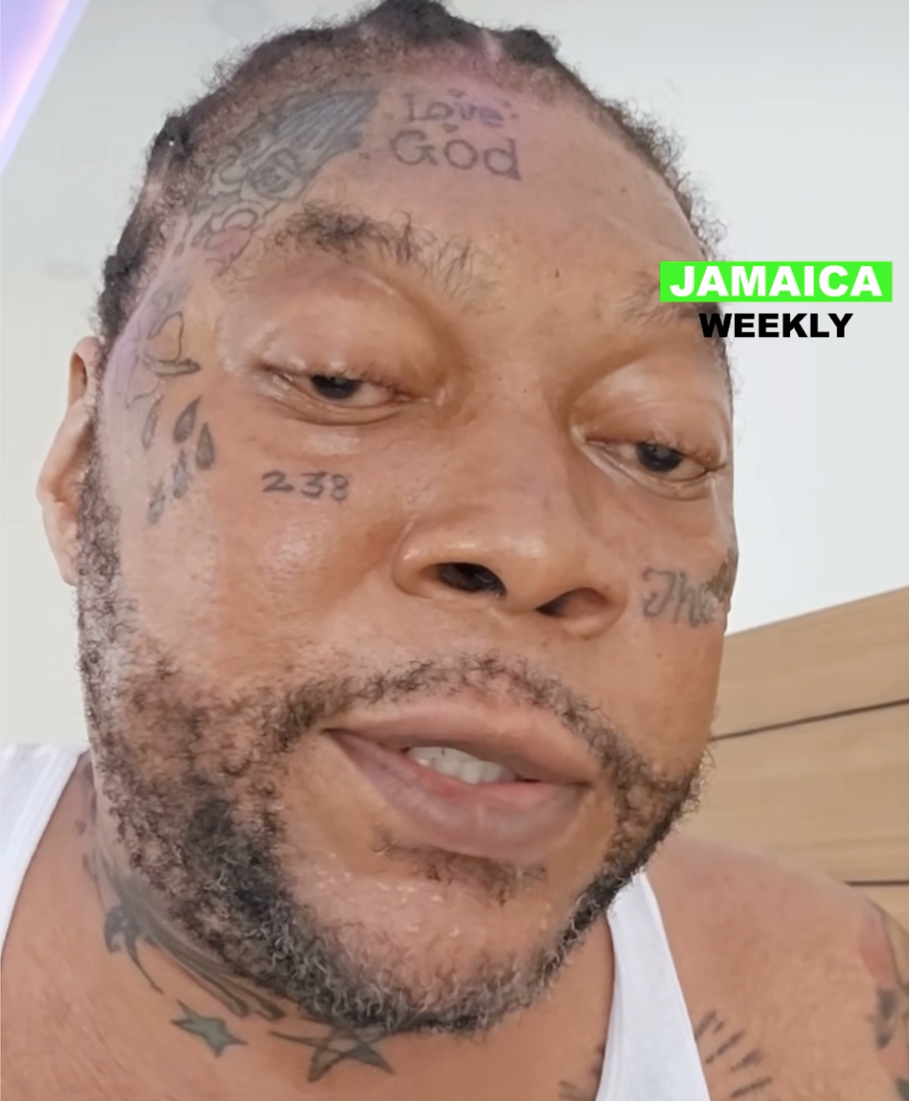 Vybz Kartel Graves Disease